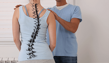 how to reverse Your Scoliosis